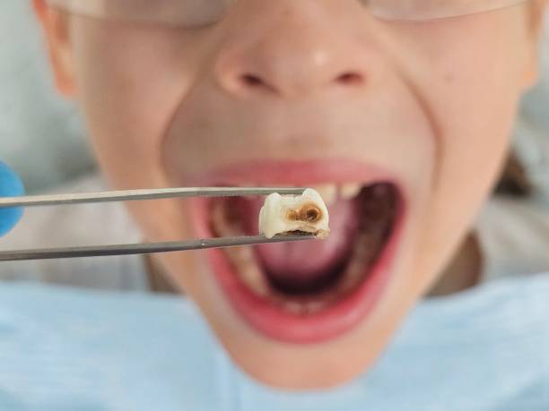 Best Pediatric Emergency Dentist in Slayton, MN